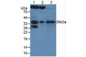 Figure. (SFRP5 anticorps  (AA 45-162))