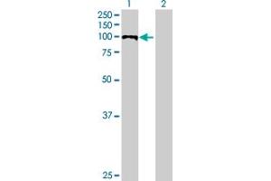 Western Blot analysis of PDCD6IP expression in transfected 293T cell line by PDCD6IP MaxPab polyclonal antibody. (ALIX anticorps  (AA 1-868))