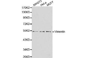 Western blot analysis of extracts of various cell lines, using VIM antibody. (Vimentin anticorps)