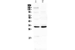 Western blot analysis of IL1 beta using anti-IL1 beta antibody .