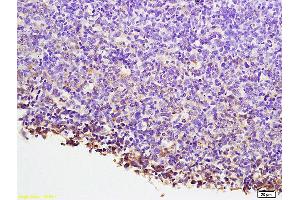 Formalin-fixed and paraffin embedded mouse lymphoma labeled with Anti-NFATC1/NFAT2 Polyclonal Antibody, Unconjugated (ABIN686257) at 1:200 followed by conjugation to the secondary antibody and DAB staining.
