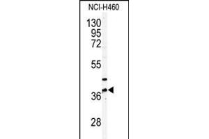 Western blot analysis of anti-NK3 Antibody (N-term) (ABIN391239 and ABIN2841307) in NCI- cell line lysates (35 μg/lane). (PANK3 anticorps  (N-Term))