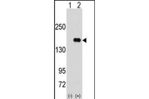PUM2 anticorps  (N-Term)