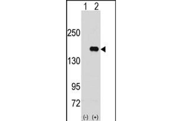 PUM2 anticorps  (N-Term)