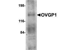 Western Blotting (WB) image for anti-Oviductal Glycoprotein 1 (OVGP1) (N-Term) antibody (ABIN1031498) (OVGP1 anticorps  (N-Term))