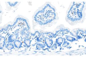 Immunohistochemistry (IHC) image for anti-CD28 (CD28) (AA 170-220) antibody (ABIN7455122) (Recombinant CD28 anticorps  (AA 170-220))