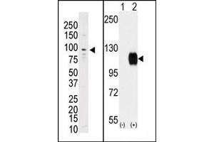 Image no. 1 for anti-TYRO3 Protein Tyrosine Kinase (TYRO3) (C-Term) antibody (ABIN359940) (TYRO3 anticorps  (C-Term))