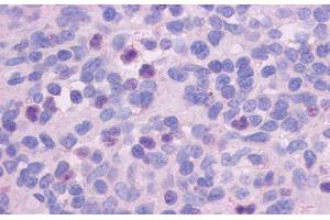 Anti-FPR1 antibody  ABIN1048601 IHC staining of human spleen. (FPR1 anticorps  (Extracellular Domain))