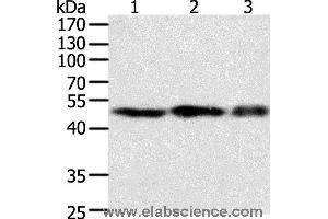 Western blot analysis of NIH/3T3, 293T and Jurkat cell, using F7 Polyclonal Antibody at dilution of 1:400 (Factor VII anticorps)