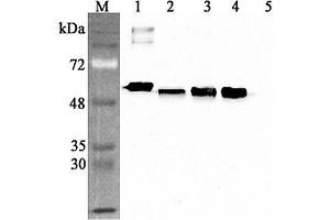 Western blot analysis using anti-Calreticulin (human), pAb  at 1:4'000 dilution. (Calreticulin anticorps)
