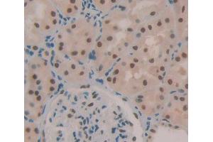 Used in DAB staining on fromalin fixed paraffin- embedded kidney tissue (TCEA1 anticorps  (AA 1-228))
