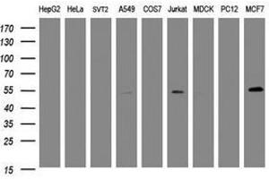 Image no. 2 for anti-TAP Binding Protein-Like (TAPBPL) antibody (ABIN1501305)