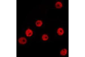 ABIN6277656 staining Hela by IF/ICC. (ZEB1 anticorps  (Internal Region))