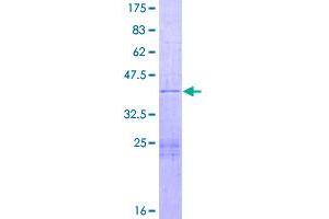 Image no. 1 for Nuclear Factor of kappa Light Polypeptide Gene Enhancer in B-Cells Inhibitor, delta (NFKBID) (AA 1-150) protein (GST tag) (ABIN1312495)