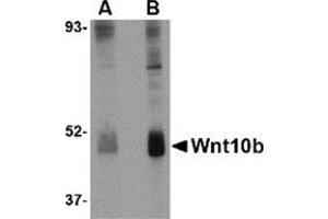 Western blot analysis of Wnt10b in human skeletal muscle tissue lysate with this product at (A) 2 and (B) 4 μg/ml.