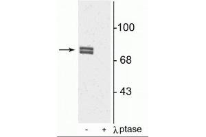 Western blot of rat cortical lysate showing specific immunolabeling of the ~80 kDa doublet of 5-LO phosphorylated at Ser523 in the first lane (-). (ALOX5 anticorps  (pSer523))