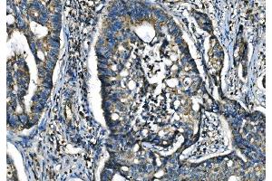 IHC analysis of CX3CR1 using anti-CX3CR1 antibody (ABIN7599293). (CX3CR1 anticorps  (AA 1-345))