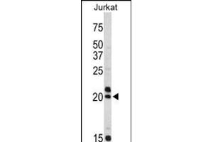 Western blot analysis of VIP antibody (C-term) (ABIN390468 and ABIN2840836) in Jurkat cell line lysates (35 μg/lane). (Vip anticorps  (C-Term))