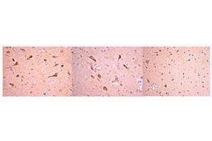 Immunohistochemistry: 1:50-1:300 working dilutions of anti-Prion Protein, clone 2G11 localizes prion protein in rat brain paraffin embedded tissue (High & Low Magnification).