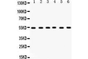 Western Blotting (WB) image for anti-Dihydrolipoamide Dehydrogenase (DLD) (AA 300-509) antibody (ABIN3043561) (DLD anticorps  (AA 300-509))