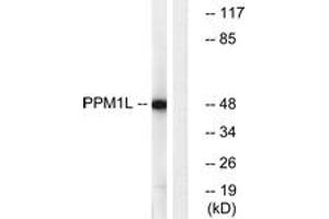 Western Blotting (WB) image for anti-Protein Phosphatase, Mg2+/Mn2+ Dependent, 1L (PPM1L) (AA 119-168) antibody (ABIN2890546) (PPM1L anticorps  (AA 119-168))