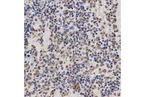 Immunohistochemistry (IHC) image for anti-Histone H3 (H3) (H3K36me3) antibody (ABIN3016039)