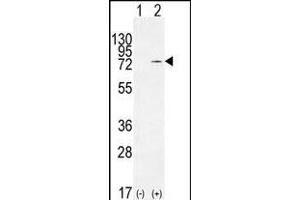 Western blot analysis of NCL (arrow) using rabbit polyclonal NCL Antibody (Center ) (ABIN655626 and ABIN2845105).