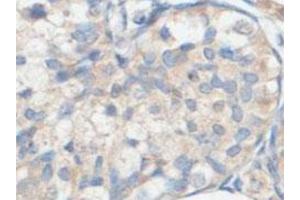 Immunohistochemical analysis of paraffin-embedded human fetal testis showing cytoplasmic staining with ACOT9 polyclonal antibody  at a 1 : 100 dilution. (ACOT9 anticorps  (AA 3-212))
