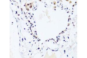 Immunohistochemistry of paraffin-embedded Human lung using BRIX1 Polyclonal Antibody at dilution of 1:100 (40x lens). (BRIX1 anticorps)