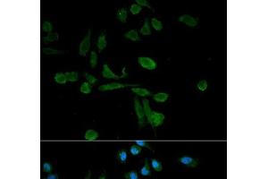 Immunofluorescence analysis of HeLa cells using SIRT7 Polyclonal Antibody (SIRT7 anticorps)