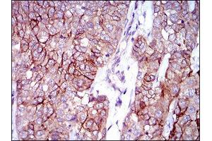 Immunohistochemistry (IHC) image for anti-Activated Leukocyte Cell Adhesion Molecule (ALCAM) (AA 48-216) antibody (ABIN1846221)