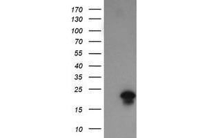Image no. 6 for anti-Fetal and Adult Testis Expressed 1 (FATE1) antibody (ABIN1498222)