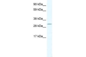 Western Blotting (WB) image for anti-Doublesex and Mab-3 Related Transcription Factor 2 (DMRT2) antibody (ABIN2461540) (DMRT2 anticorps)