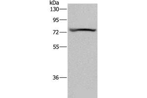 Western Blot analysis of Mouse heart tissue using KCNQ1 Polyclonal Antibody at dilution of 1:200
