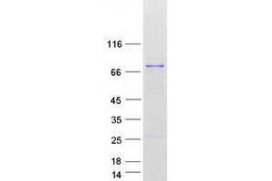Validation with Western Blot