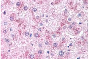 Human Liver (formalin-fixed, paraffin-embedded) stained with CRADD antibody ABIN213922 at 5 ug/ml followed by biotinylated goat anti-rabbit IgG secondary antibody ABIN481713, alkaline phosphatase-streptavidin and chromogen. (CRADD anticorps  (AA 99-117))