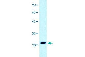 Western Blot analysis of Jurkat cell lysate with C1orf149 polyclonal antibody  at 0.
