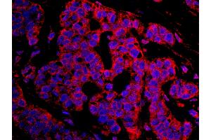 Immunofluorescence (IF) image for anti-Cancer Susceptibility Candidate 3 (CASC3) (AA 653-703) antibody (ABIN7448936) (CASC3 anticorps  (AA 653-703))