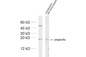 dilution: 1 : 1000, sample: unboiled synaptic membrane fraction of rat brain (LP1)