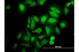 Immunofluorescence of monoclonal antibody to ABL2 on HeLa cell.