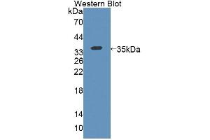Western blot analysis of the recombinant protein. (KEL anticorps  (AA 439-713))