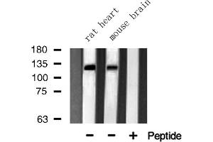 Western blot analysis of JMY using Jurkat whole cell lysates (JMY anticorps  (C-Term))