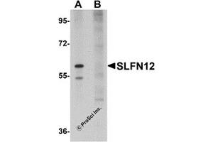 Western Blotting (WB) image for anti-Schlafen Family Member 12 (SLFN12) (C-Term) antibody (ABIN1030678) (SLFN12 anticorps  (C-Term))