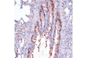 Immunohistochemistry of paraffin-embedded rat lung using RPL22 antibody (ABIN6128682, ABIN6147119, ABIN6147120 and ABIN6224925) at dilution of 1:100 (40x lens).