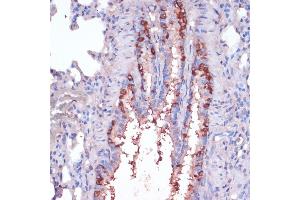 Immunohistochemistry of paraffin-embedded rat lung using RPL22 antibody (ABIN6128682, ABIN6147119, ABIN6147120 and ABIN6224925) at dilution of 1:100 (40x lens). (RPL22 anticorps  (AA 1-122))