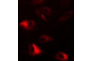 Immunofluorescent analysis of Peroxiredoxin 2 staining in HepG2 cells.