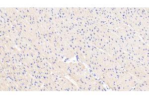 Detection of JNK1 in Human Cardiac Muscle Tissue using Polyclonal Antibody to c-Jun N-terminal Kinase 1 (JNK1)