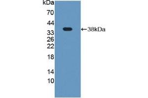 Western blot analysis of recombinant Rat Plg. (PLG anticorps  (AA 191-433))