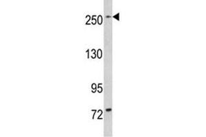 Western blot analysis of LRRK1 in mouse bladder tissue lysate (LRRK1 anticorps  (AA 1981-2015))