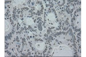 Image no. 4 for anti-Premelanosome Protein (PMEL) antibody (ABIN1500300)